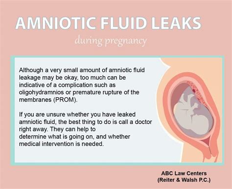 can amniotic fluid leak and then stop|Leaking amniotic fluid: Signs and what to do